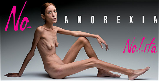 anorexia fashion campaign